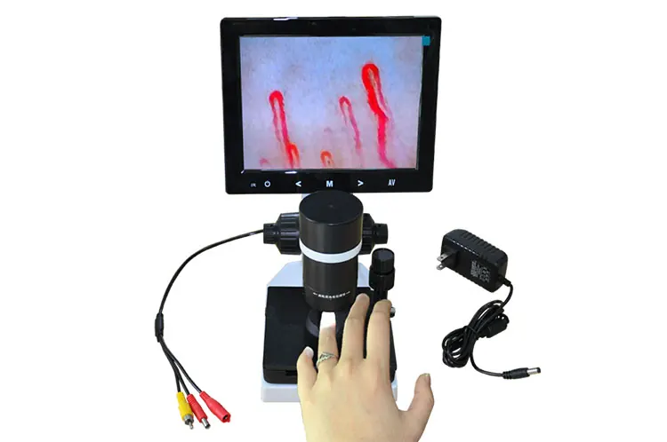 HT-WXHP HD 400X Microcirculation Detector 8 Inch Display view 2