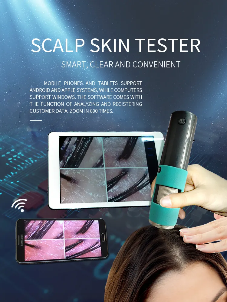 M30F Wireless WiFi Digital Scalp Skin Tester Detector Zoom 600X view 2
