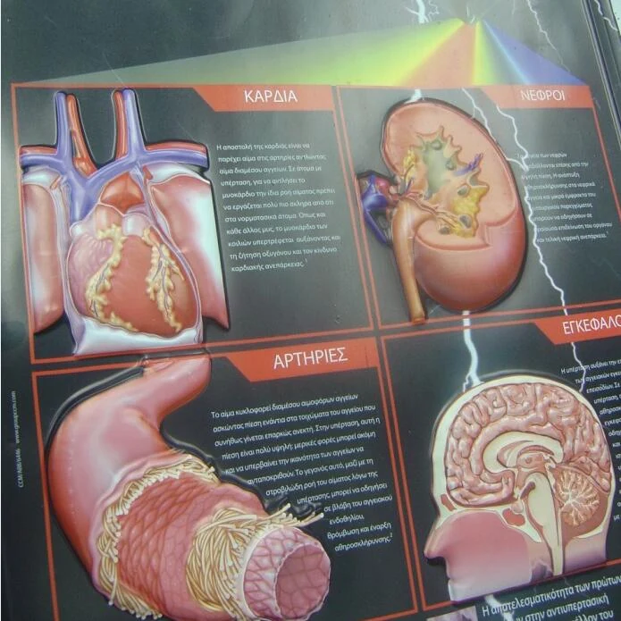 3D embossed medical wall chart showing raised organ structures