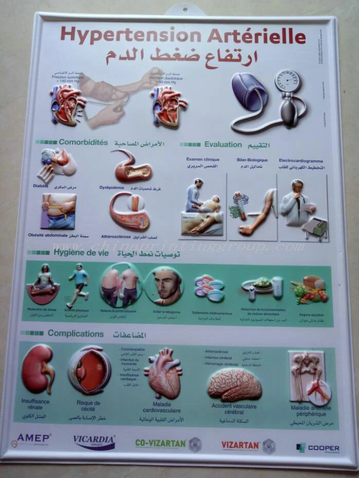 UV printed PVC poster mounted on a clinic wall