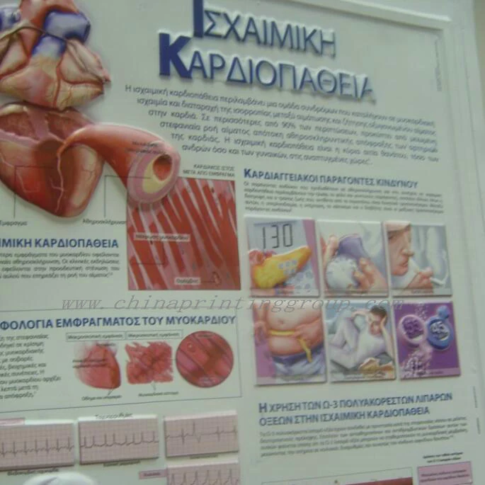 Set of embossed PVC medical posters laid out flat