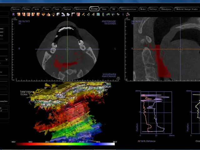 Anatomage airway analysis