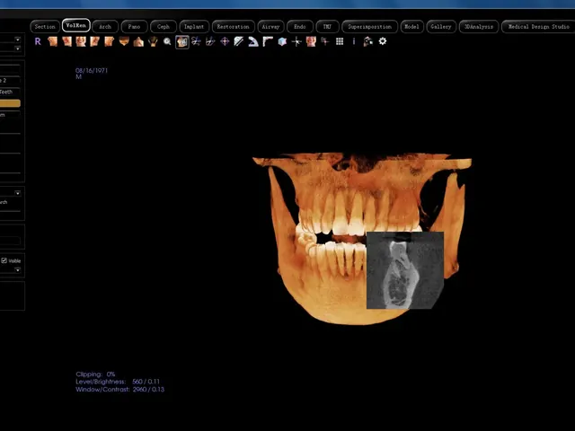 Anatomage volume rendering