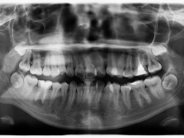Planmeca ProOne