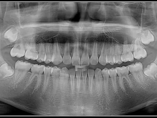 2-in-1 Panoramic Plus Cephalometric Sourcing: Orthodontic Practice Imaging from Shanghai
