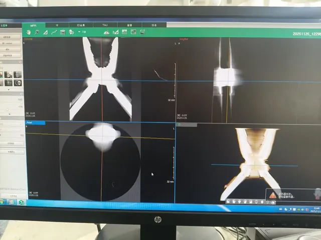 CBCT Radiation Dose and Imaging Protocols: Platform Selection Guide for Dental Buyers