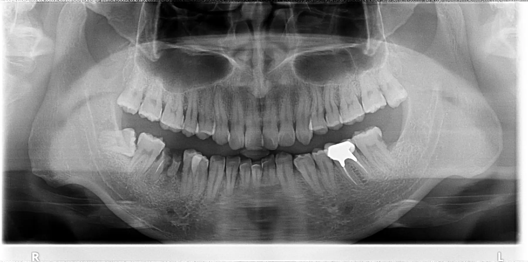 Dental RVG Intraoral X-Ray Sensor Sourcing from Shanghai: CMOS Digital Sensor Guide