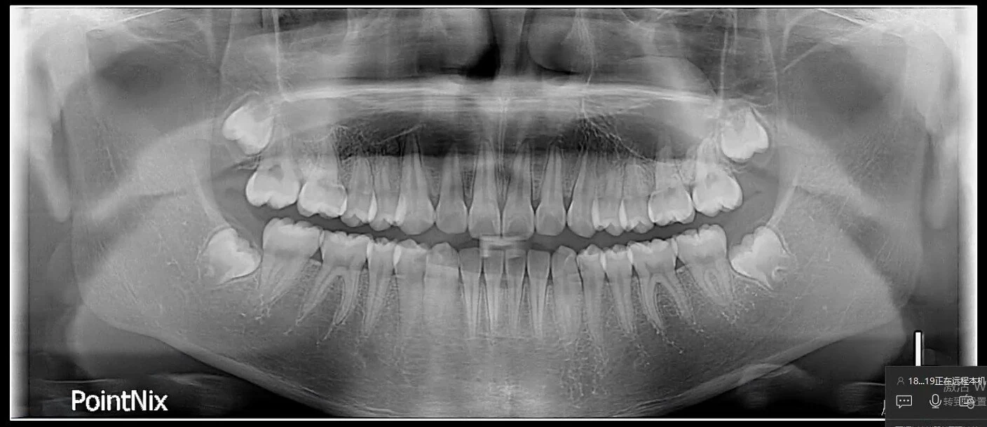 2-in-1 Panoramic Plus Cephalometric Sourcing: Orthodontic Practice Imaging from Shanghai