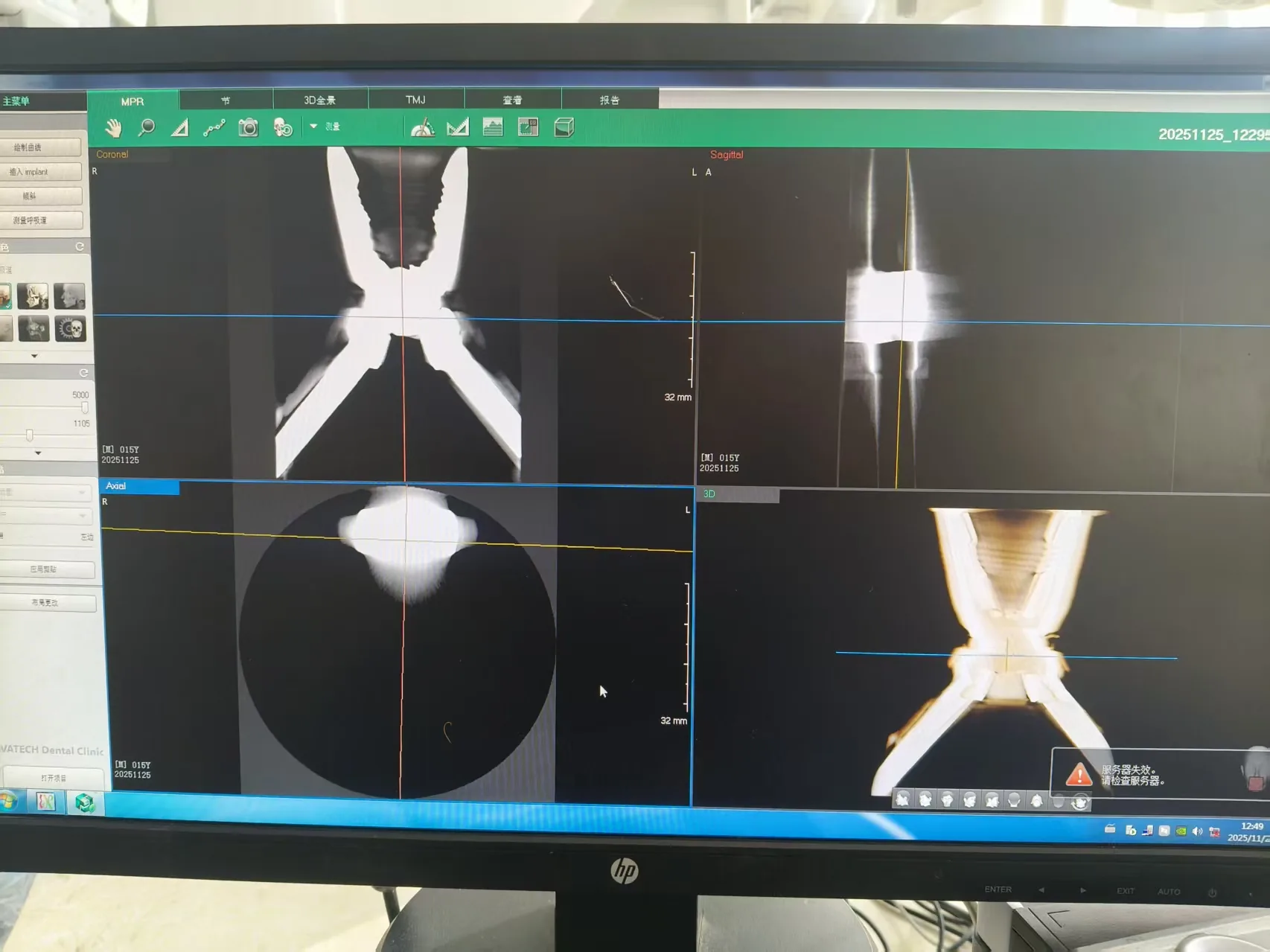CBCT Radiation Dose and Imaging Protocols: Platform Selection Guide for Dental Buyers