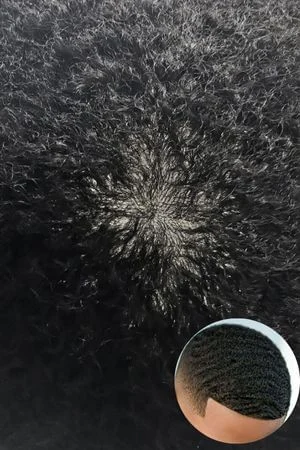 Side view of the FCS skin base showing the 0.08mm thickness and natural hairline