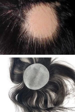Bald Spot Hair Patch Toupee for Men shown from above with the thin skin base and front hairline visible