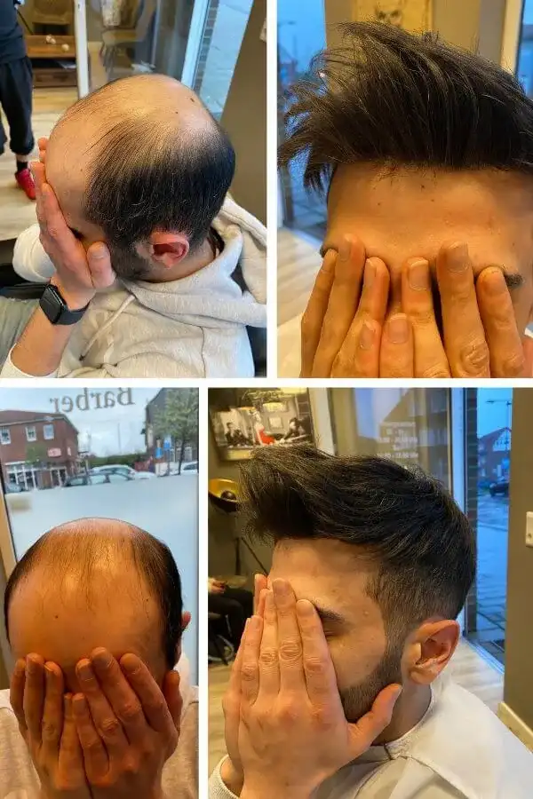 DMS hair system styled on a mannequin head showing the front parting and natural hairline