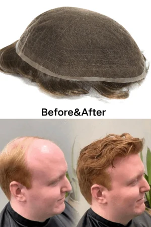 AFL French lace hair system shown from above with the front hairline visible