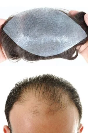 Thin Skin Hairline Patch For Men shown from above with the front hairline visible