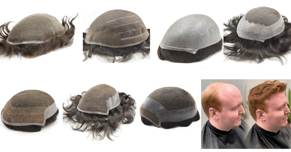 A range of HairNotion hair system bases photographed together