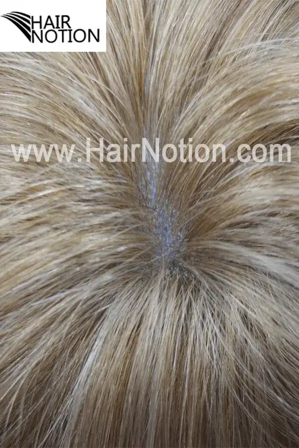 Back view of the IS-DE hair system showing the full injected skin coverage