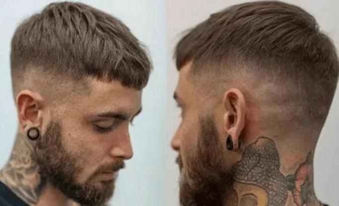 Two views of a man wearing a hair system cut into his own hairline
