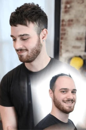 Before and after image of a man wearing a Swiss lace toupee, showing natural appearance and fit
