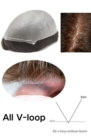 Poly thin skin hair system for men shown from above with the front hairline visible