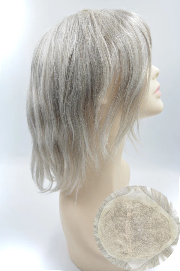 Woman's hair replacement system with full Swiss lace base, showing the natural hairline and front bleached knots