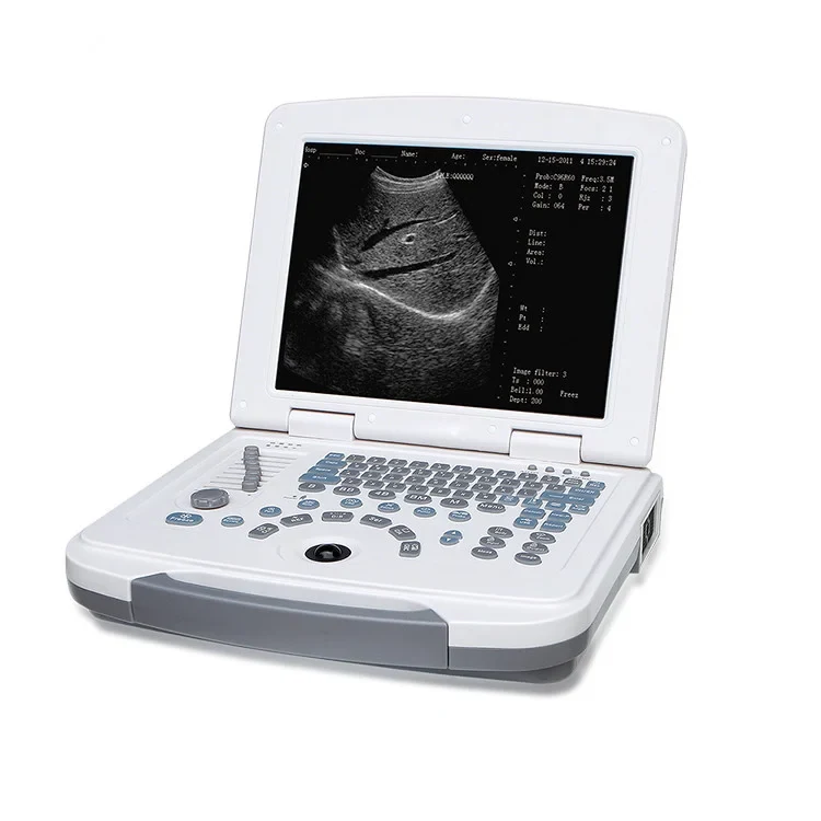 Full Digital Laptop Ultrasound Scanner