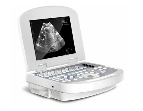 Laptop Full Digital Ultrasound Scanner