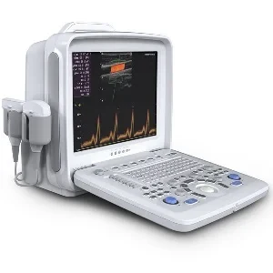 Portable Color Doppler Ultrasonic System