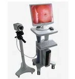 Video Colposcope view 2