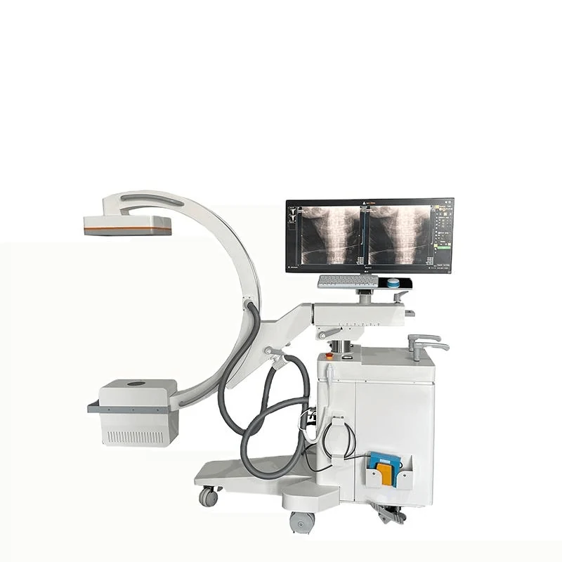 C arm X ray machine with digital detector and monitor cart