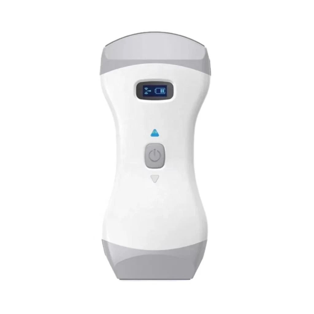How Medical Ultrasound Equipment Works and How to Choose It