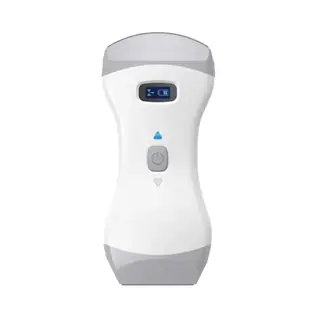 How Medical Ultrasound Equipment Works and How to Choose It