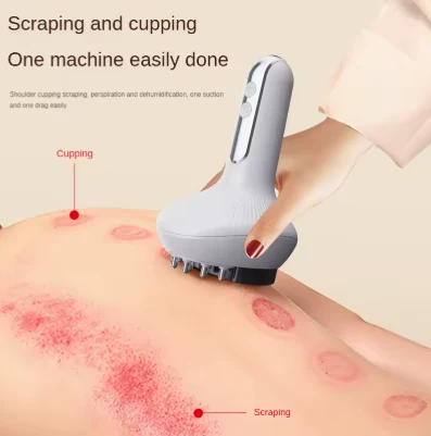 Vacuum cupping cup with adjustable suction valve