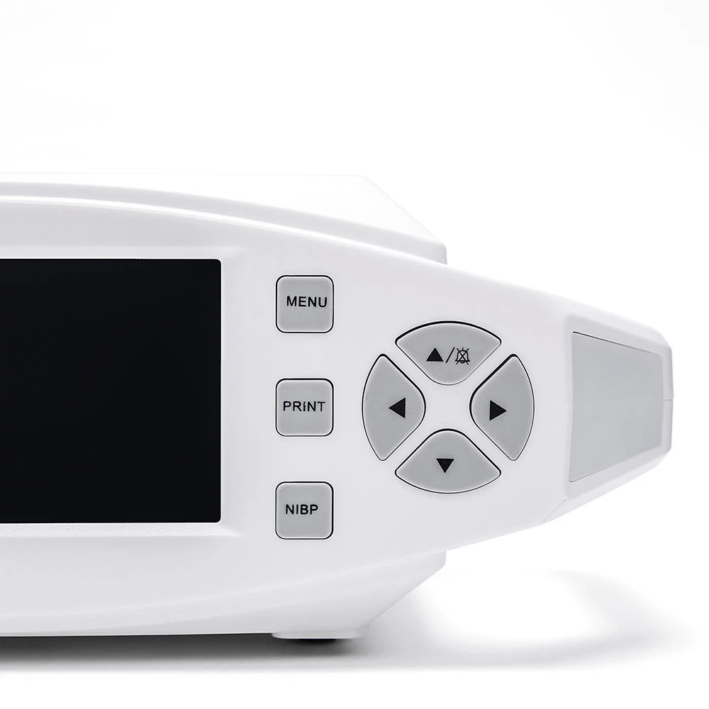 Vital sign monitor displaying ECG SpO2 and NIBP readings