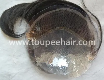 Top Closure and Frontal