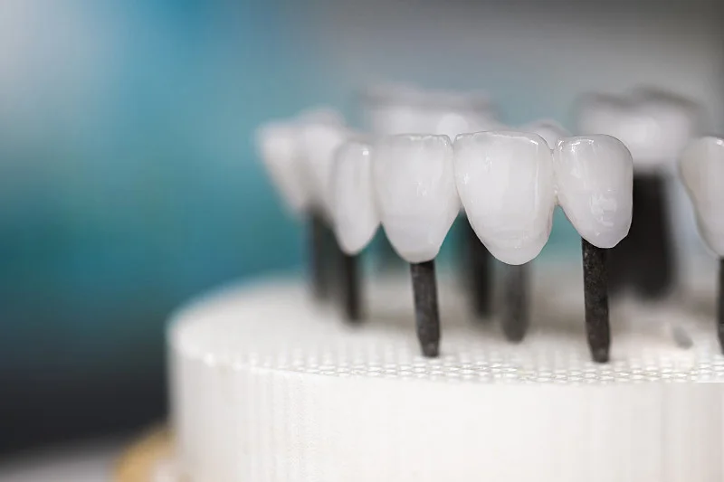 Exploring Zirconia Dental Prosthesis Sintering Technology: Key Parameters and Best Practices